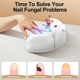 Multiple Antifungal Nail Device